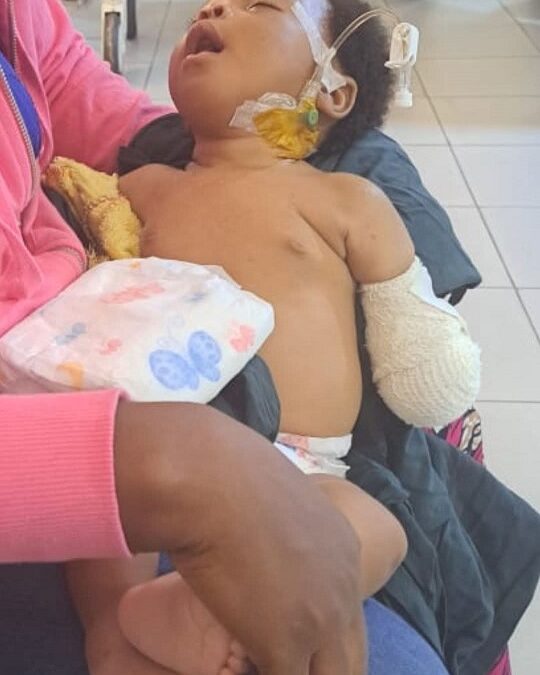 A Baby’s Hand, A Nation’s Failure