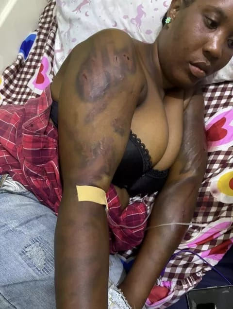 FOR ALLEGEDLY BRUTALIZING A WOMAN: